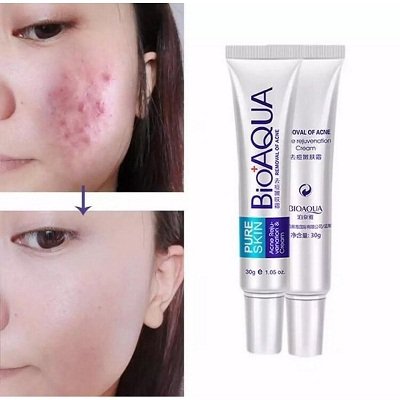 Bioaqua Acne Cream Price In Pakistan 03000314766 - Online Shopping in Pakistan,Lahore,Karachi,Islamabad,Bahawalpur,Peshawar,Multan,Rawalpindi - Fareedshopping.com